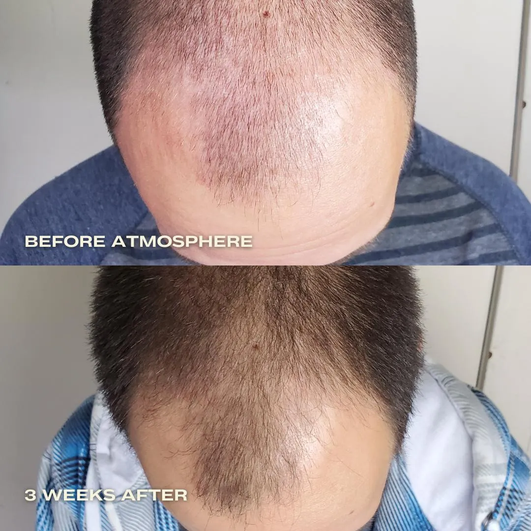 Atmosphere Hair Density & Scalp Serum